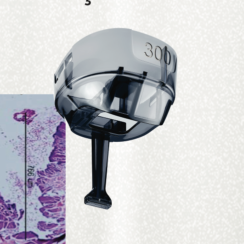 Ponteira de 300 µm do eCO2 3D