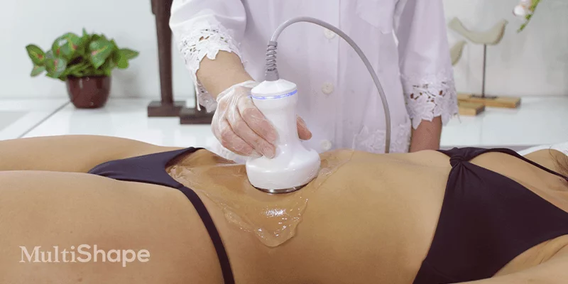 Contourline_-_Dez_04_-_Ultrassom_Cavitacional,_saiba_tudo_sobre_a_tecnologia_que_age_com_eficiência_na_redução_de_células_de_gordura