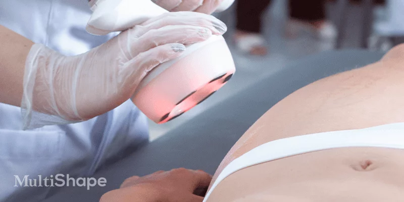 Entenda como funciona a radiofrequência Multipolar