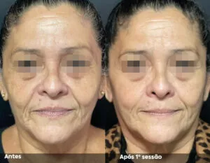 RESULTADO DE 1 SESSÃO