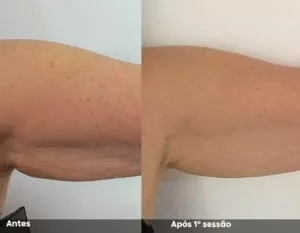 RESULTADO DE 1 SESSÃO