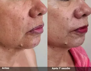 RESULTADO DE 1 SESSÃO