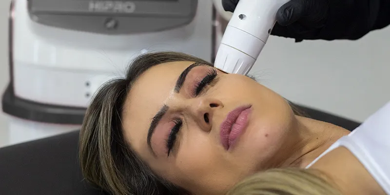 Ultrassom Microfocado Hifu
