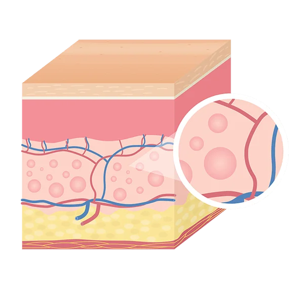 processo-inflamatorio