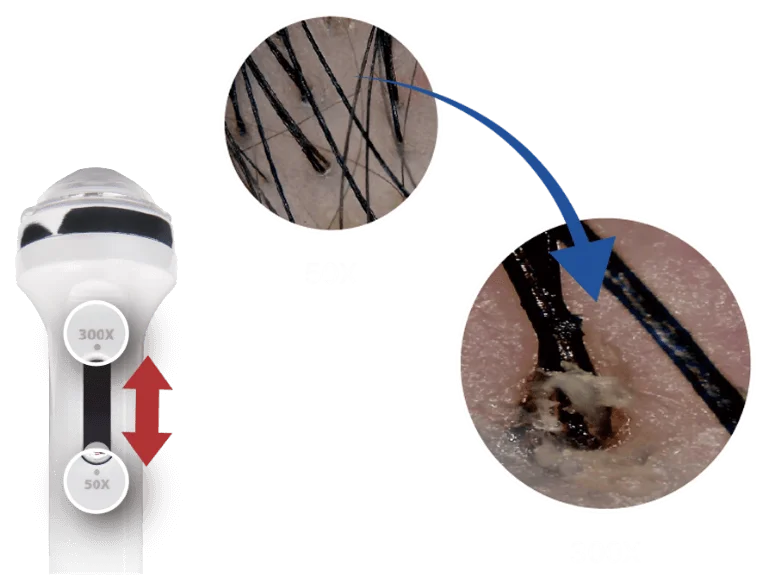 Zoom do Fio Capilar com o Hive PRO