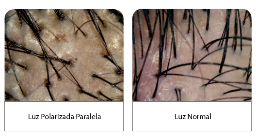 Luz Paralela HIVEPRO
