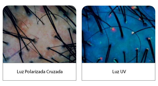 Luz Polarizada Hive Pro